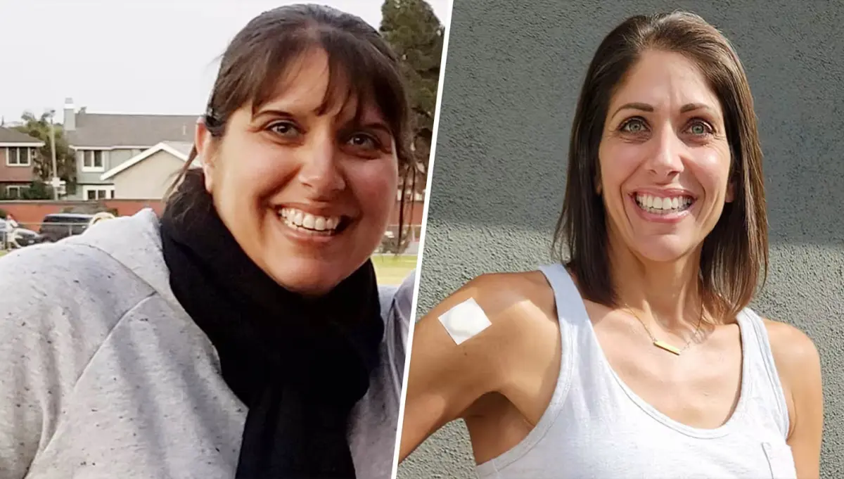 Before and After