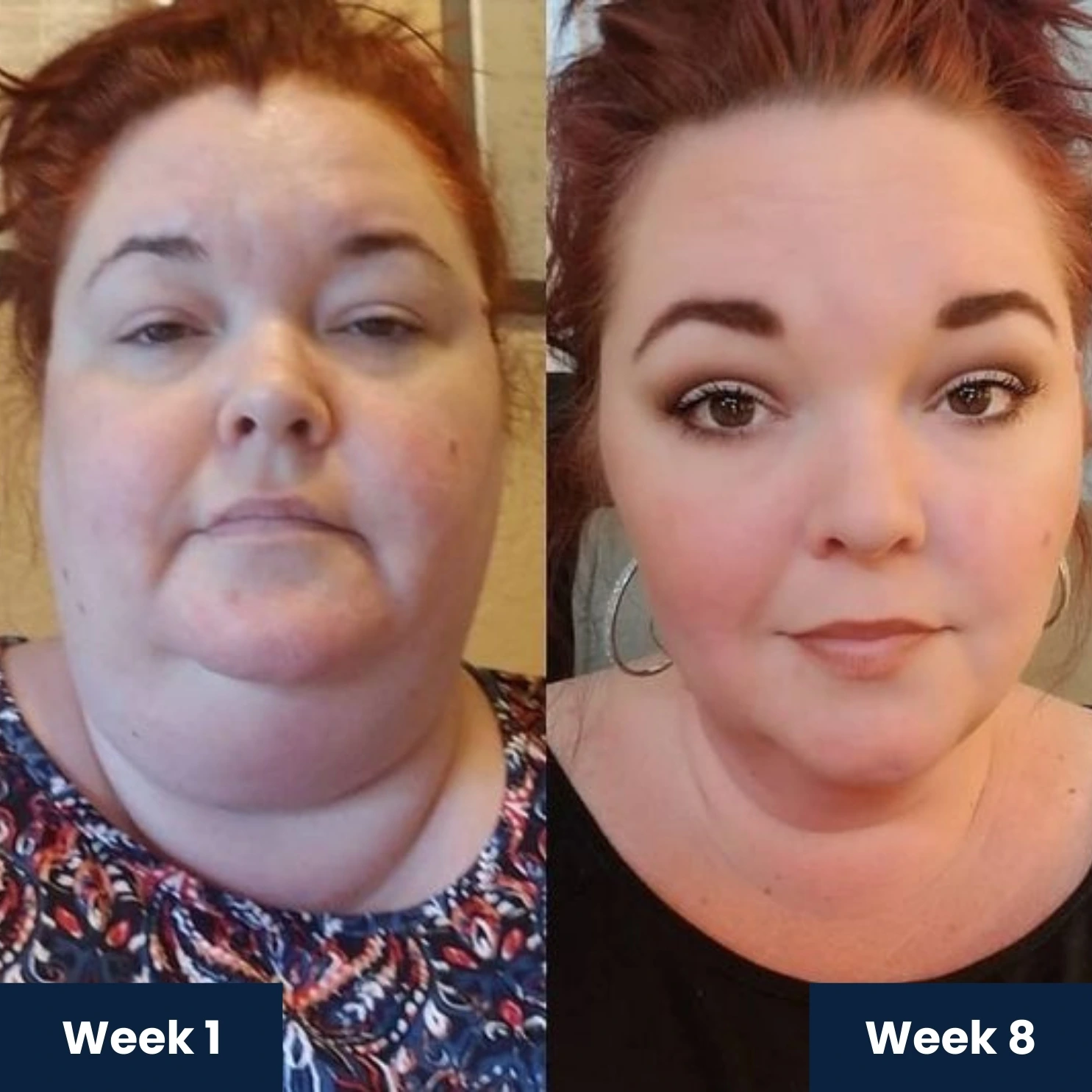 Before and After